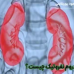 سندروم نفروتیک چیست