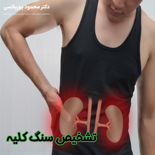 تشخیص سنگ کلیه