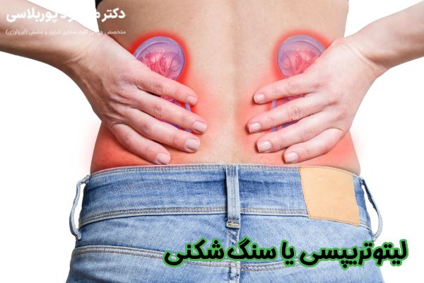 لیتوتریپسی یا سنگ‌ شکنی