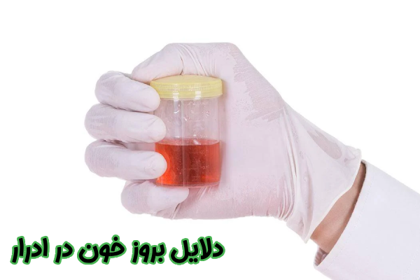 دلایل بروز خون در ادرار