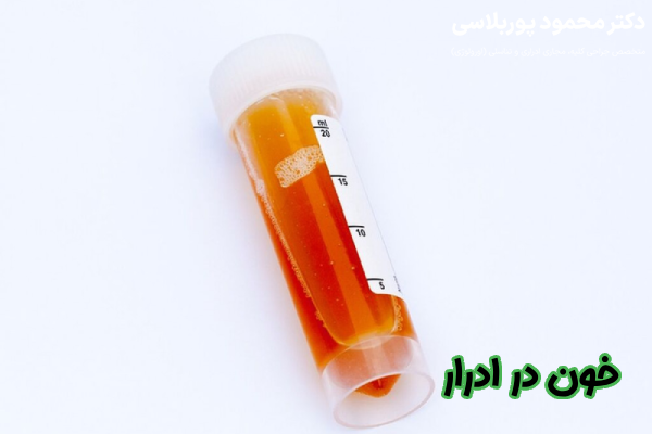 خون در ادرار چیست