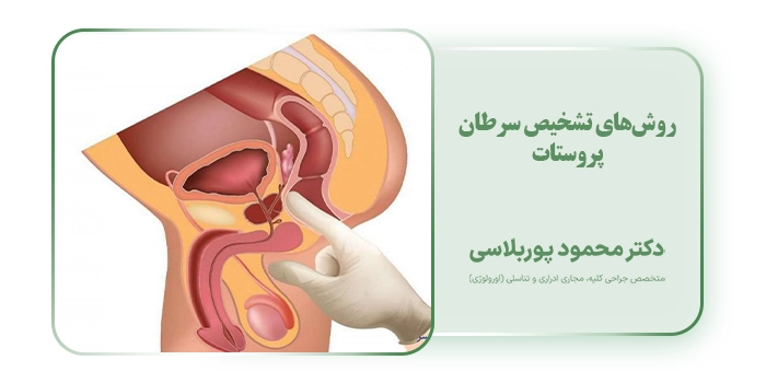 روش‌های تشخیص سرطان پروستات