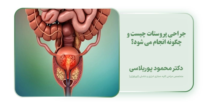 جراحی پروستات چیست و چگونه انجام می شود؟