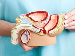 درمان بزرگی پروستات بدون جراحی