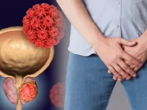 عفونت پروستات