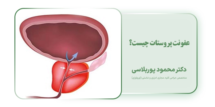 عفونت پروستات چیست؟