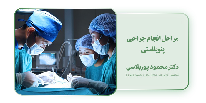 مراحل انجام جراحی پنوپلاستی